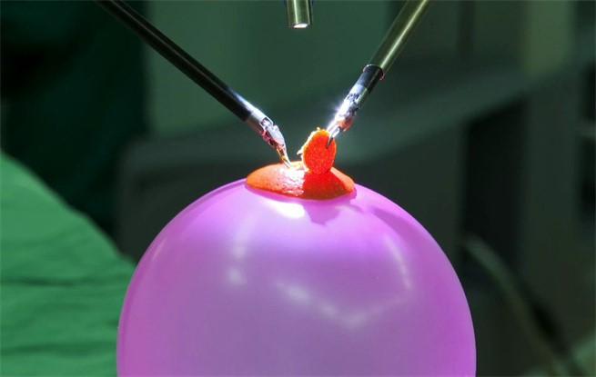 Surgeon performs simulated breast cancer surgery on a balloon